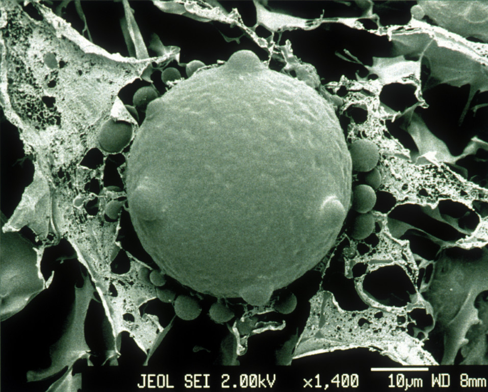 A microscopic image of a zoospore of Bd. A large spherical structure dominates the image, surrounded by webbing and smaller spheres.